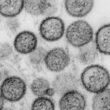 WHO: Hantavirus auf Schiff wurde von Mensch zu Mensch übertragen