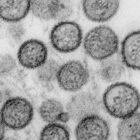 WHO: Hantavirus auf Schiff wurde von Mensch zu Mensch übertragen