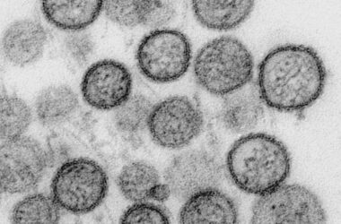 WHO: Hantavirus auf Schiff wurde von Mensch zu Mensch übertragen