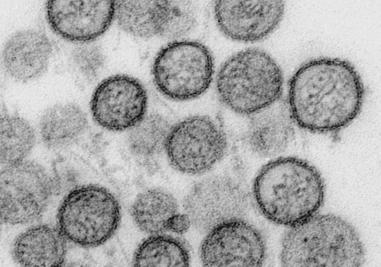 WHO: Hantavirus auf Schiff wurde von Mensch zu Mensch übertragen